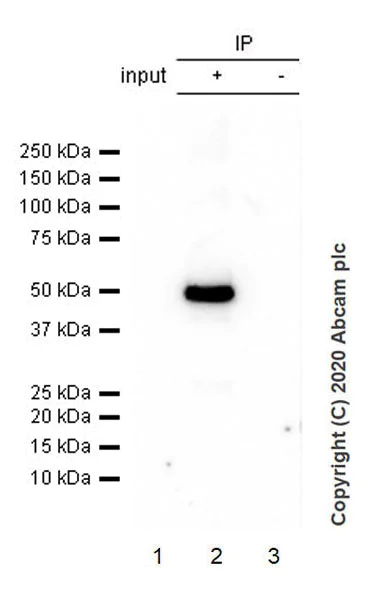Immunoprecipitation - Anti-GABA A Receptor alpha 1 antibody [EPR23539-255] - BSA and Azide free (AB272398)