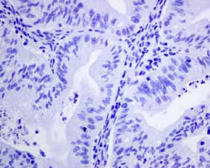 Immunohistochemistry (Formalin/PFA-fixed paraffin-embedded sections) - Anti-GABA A Receptor alpha 1 antibody [EPR5401(2)] (AB151573)