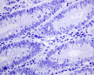 Immunohistochemistry (Formalin/PFA-fixed paraffin-embedded sections) - Anti-GABA A Receptor alpha 1 antibody [EPR5401(2)] (AB151573)