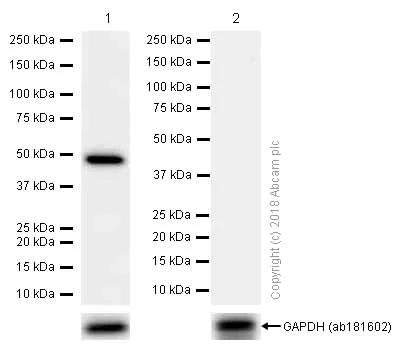 Western blot - Anti-GABA A Receptor alpha 1 antibody [EPR5401(2)] (AB151573)