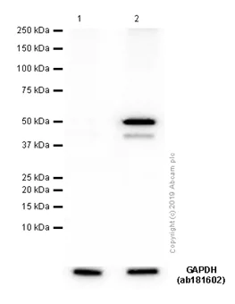 Western blot - Anti-GABA A Receptor alpha 1 antibody [EPR5401(2)] (AB151573)