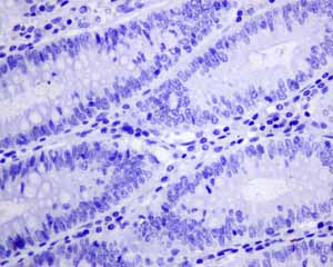 Immunohistochemistry (Formalin/PFA-fixed paraffin-embedded sections) - Anti-GABA A Receptor alpha 1 antibody [EPR5401(2)] - BSA and Azide free (AB236057)