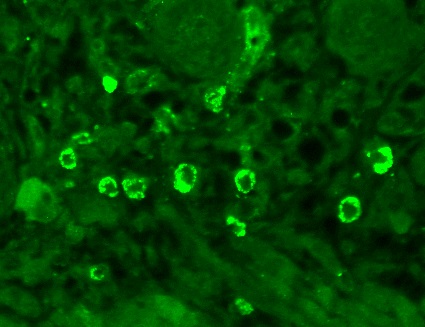 Immunohistochemistry (Formalin/PFA-fixed paraffin-embedded sections) - Anti-GABA A Receptor alpha 1 antibody [N95/35] (AB94585), expandable thumbnail