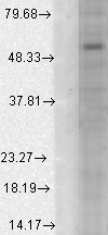 Western blot - Anti-GABA A Receptor alpha 1 antibody [N95/35] (AB94585), expandable thumbnail