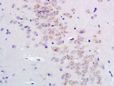 Immunohistochemistry (Formalin/PFA-fixed paraffin-embedded sections) - Anti-GABA A Receptor alpha 2/GABRA2 antibody (AB216973), expandable thumbnail