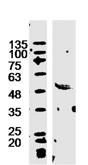 Western blot - Anti-GABA A Receptor alpha 2/GABRA2 antibody (AB216973)