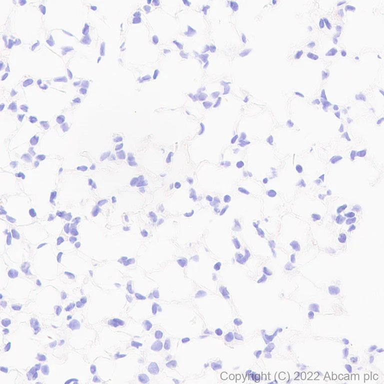 Immunohistochemistry (Formalin/PFA-fixed paraffin-embedded sections) - Anti-GABA A Receptor alpha 2/GABRA2 antibody [EPR26485-185] (AB307359)