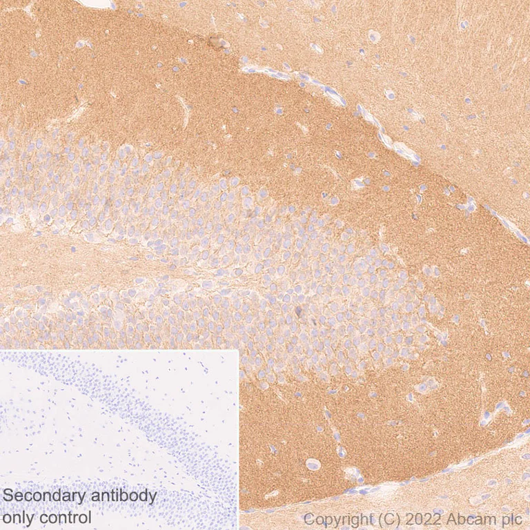 Immunohistochemistry (Formalin/PFA-fixed paraffin-embedded sections) - Anti-GABA A Receptor alpha 2/GABRA2 antibody [EPR26485-185] - BSA and Azide free (AB307360)
