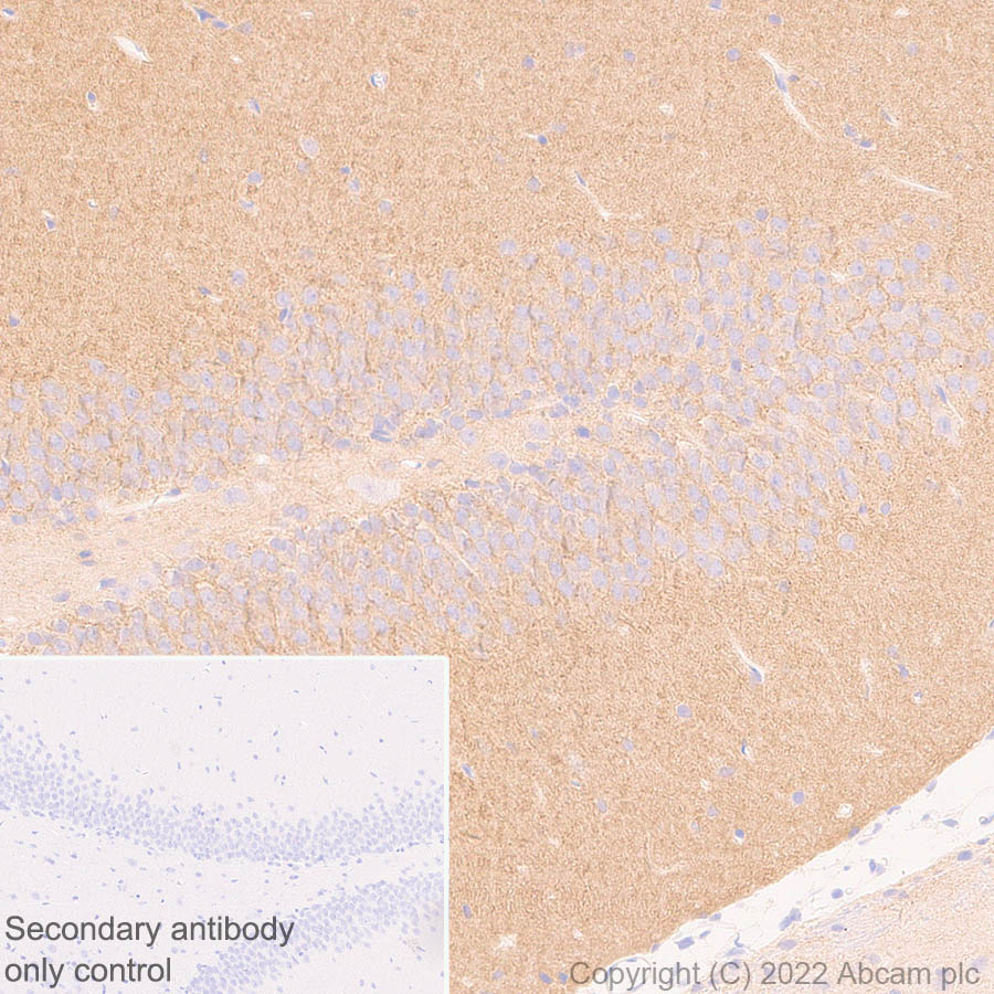 Immunohistochemistry (Formalin/PFA-fixed paraffin-embedded sections) - Anti-GABA A Receptor alpha 2/GABRA2 antibody [EPR26485-185] - BSA and Azide free (AB307360), expandable thumbnail