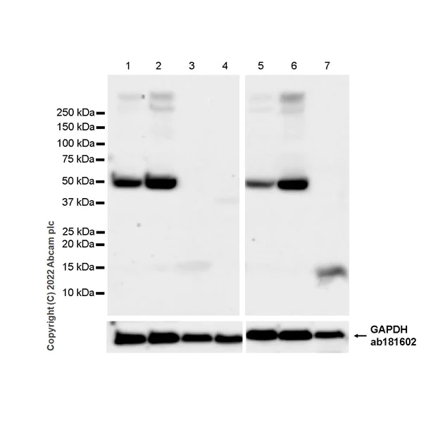 Western blot - Anti-GABA A Receptor alpha 2/GABRA2 antibody [EPR26485-185] - BSA and Azide free (AB307360)