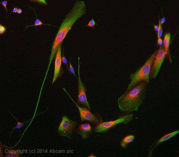 Immunocytochemistry/ Immunofluorescence - Anti-GABA A Receptor alpha 2/GABRA2 antibody [N399/19] (AB193311)