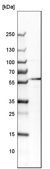 Western blot - Anti-GABA A Receptor alpha 3/GABRA3 antibody (AB224214)
