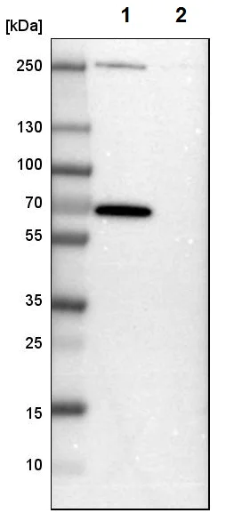 Western blot - Anti-GABA A Receptor alpha 3/GABRA3 antibody (AB224214)