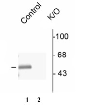 Western blot - Anti-GABA A Receptor alpha 3/GABRA3 antibody (AB72446), expandable thumbnail