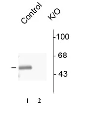 Western blot - Anti-GABA A Receptor alpha 3/GABRA3 antibody (AB72446)