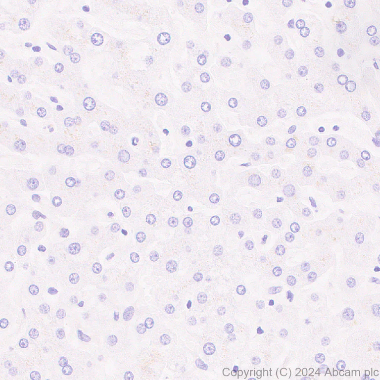 Immunohistochemistry (Formalin/PFA-fixed paraffin-embedded sections) - Anti-GABA A Receptor alpha 3/GABRA3 antibody [EPR28364-82] - BSA and Azide free (AB316970)