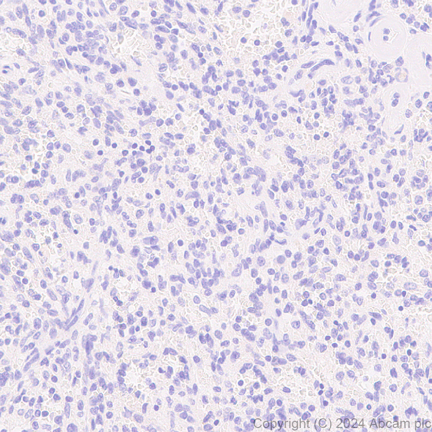 Immunohistochemistry (Formalin/PFA-fixed paraffin-embedded sections) - Anti-GABA A Receptor alpha 3/GABRA3 antibody [EPR28364-82] - BSA and Azide free (ab316970), expandable thumbnail