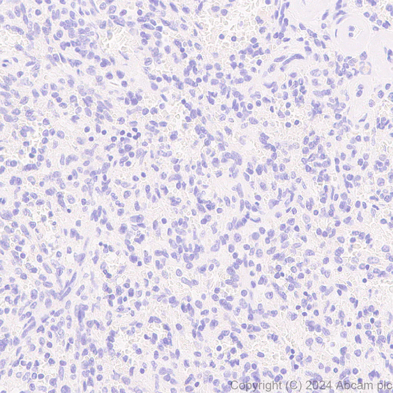 Immunohistochemistry (Formalin/PFA-fixed paraffin-embedded sections) - Anti-GABA A Receptor alpha 3/GABRA3 antibody [EPR28364-82] - BSA and Azide free (AB316970)
