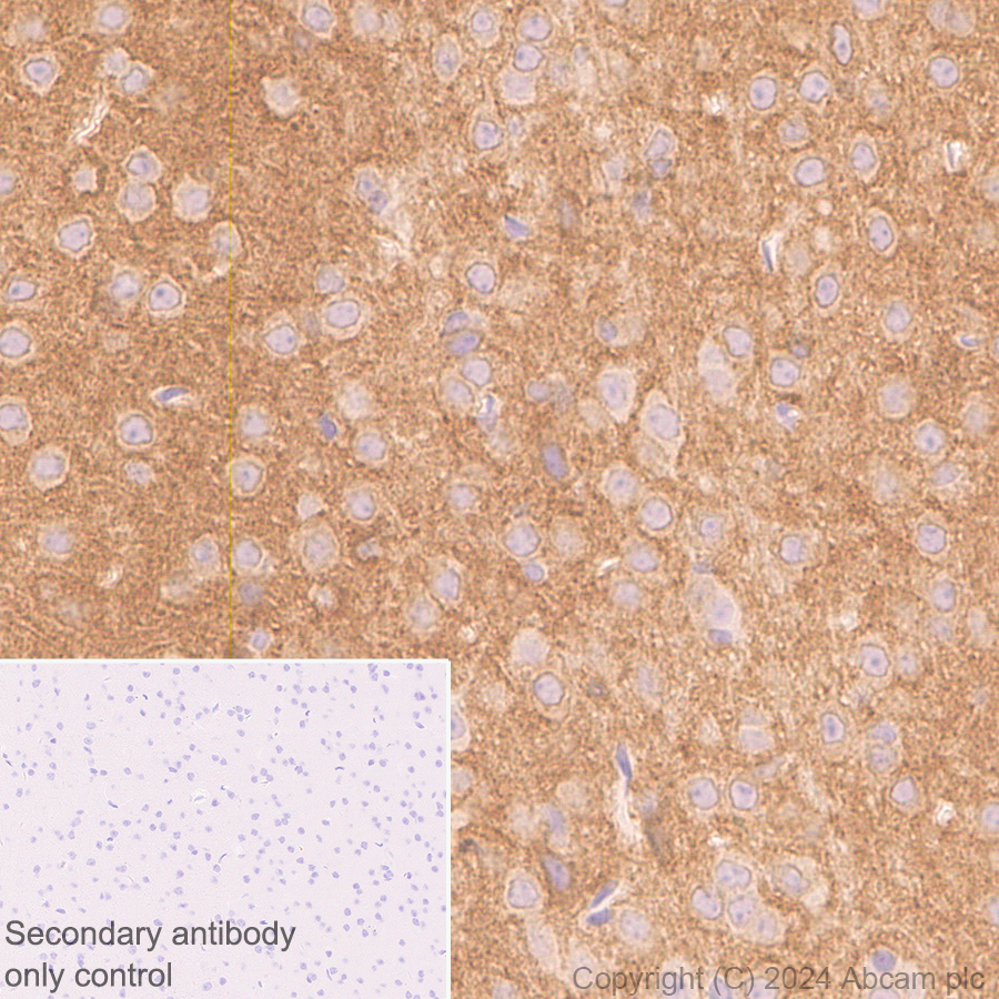 Immunohistochemistry (Formalin/PFA-fixed paraffin-embedded sections) - Anti-GABA A Receptor alpha 3/GABRA3 antibody [EPR28364-82] - BSA and Azide free (ab316970), expandable thumbnail