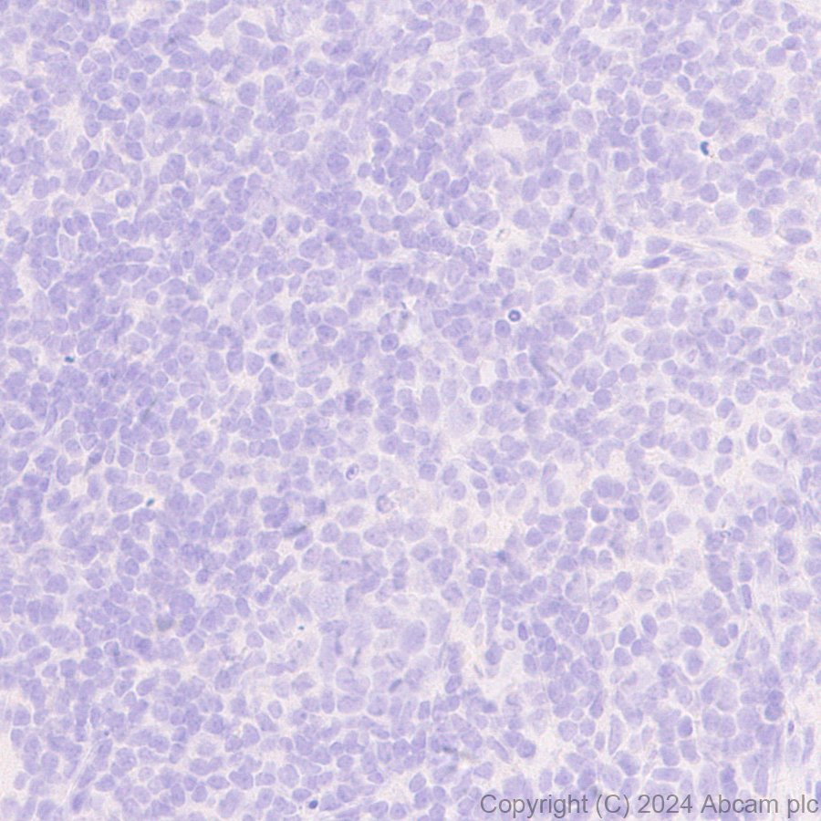 Immunohistochemistry (Formalin/PFA-fixed paraffin-embedded sections) - Anti-GABA A Receptor alpha 3/GABRA3 antibody [EPR28364-82] - BSA and Azide free (ab316970), expandable thumbnail