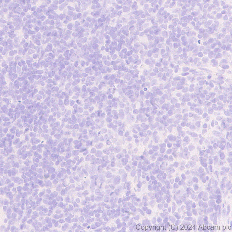 Immunohistochemistry (Formalin/PFA-fixed paraffin-embedded sections) - Anti-GABA A Receptor alpha 3/GABRA3 antibody [EPR28364-82] - BSA and Azide free (AB316970)