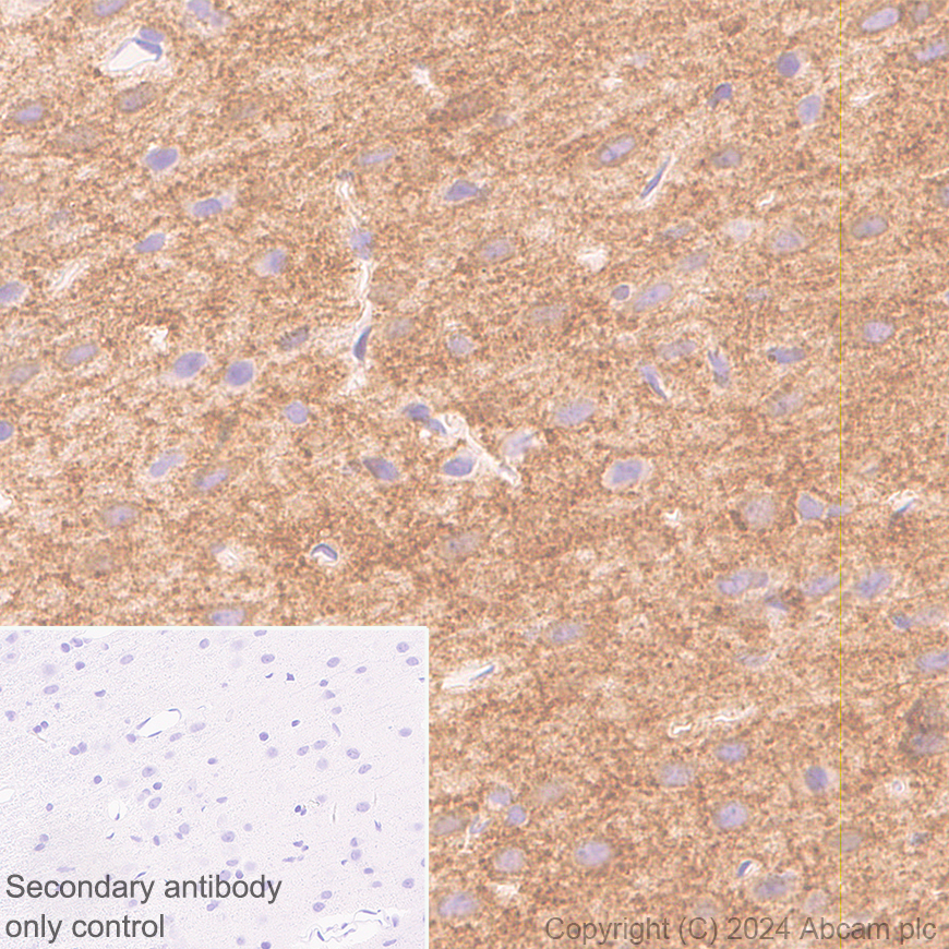 Immunohistochemistry (Formalin/PFA-fixed paraffin-embedded sections) - Anti-GABA A Receptor alpha 3/GABRA3 antibody [EPR28364-82] - BSA and Azide free (ab316970), expandable thumbnail