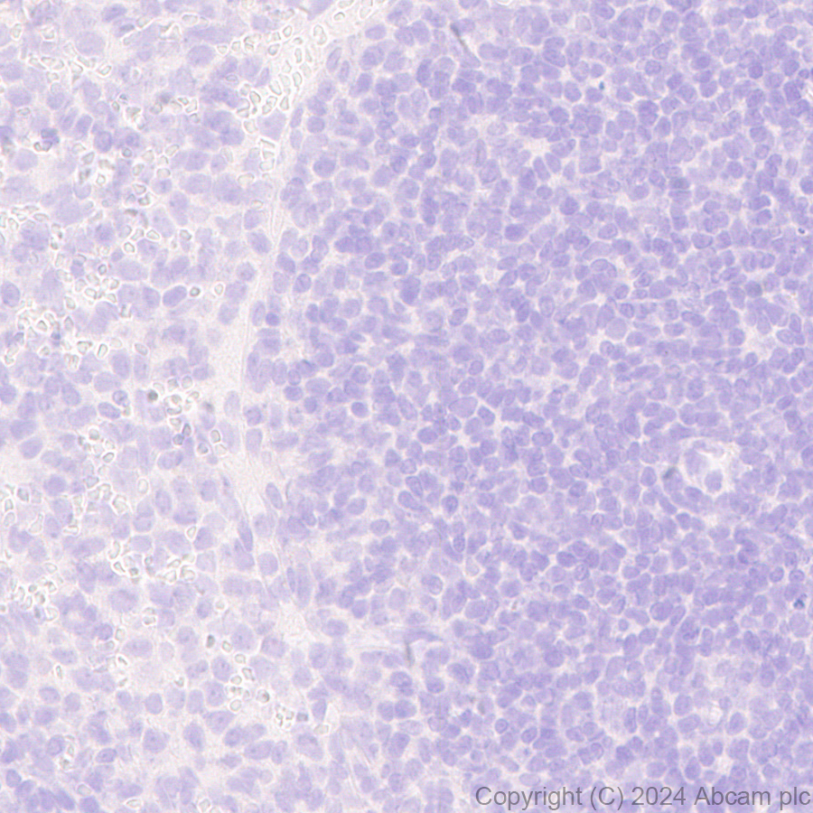 Immunohistochemistry (Formalin/PFA-fixed paraffin-embedded sections) - Anti-GABA A Receptor alpha 3/GABRA3 antibody [EPR28364-82] - BSA and Azide free (ab316970), expandable thumbnail