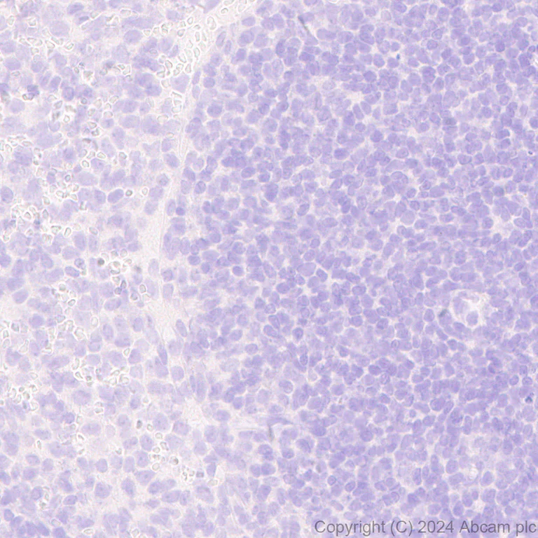 Immunohistochemistry (Formalin/PFA-fixed paraffin-embedded sections) - Anti-GABA A Receptor alpha 3/GABRA3 antibody [EPR28364-82] - BSA and Azide free (AB316970)