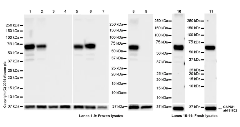 Western blot - Anti-GABA A Receptor alpha 3/GABRA3 antibody [EPR28364-82] - BSA and Azide free (AB316970)