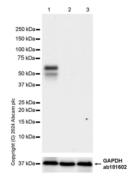 Western blot - Anti-GABA A Receptor alpha 3/GABRA3 antibody [EPR28364-82] - BSA and Azide free (AB316970)