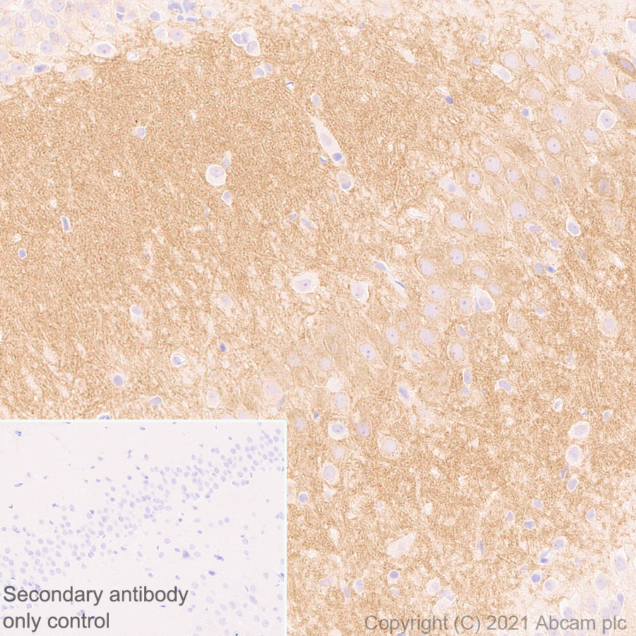 Immunohistochemistry (Formalin/PFA-fixed paraffin-embedded sections) - Anti-GABA A Receptor alpha 5/GABRA5 antibody [EPR24003-118] (AB259880), expandable thumbnail