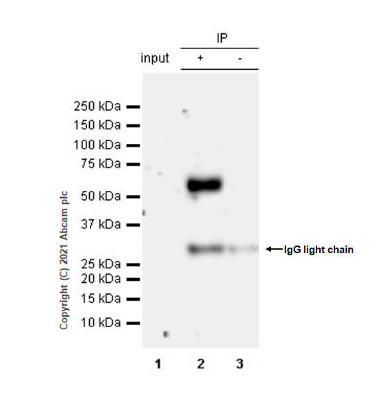 Immunoprecipitation - Anti-GABA A Receptor alpha 5/GABRA5 antibody [EPR24003-118] (AB259880), expandable thumbnail
