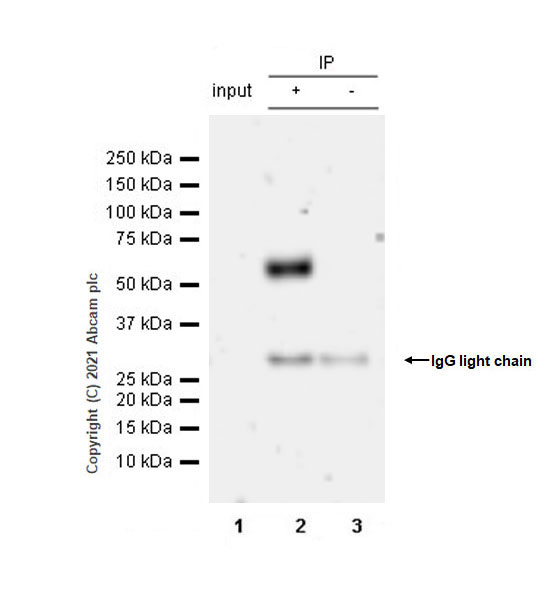 Immunoprecipitation - Anti-GABA A Receptor alpha 5/GABRA5 antibody [EPR24003-118] (AB259880), expandable thumbnail