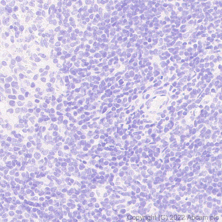 Immunohistochemistry (Formalin/PFA-fixed paraffin-embedded sections) - Anti-GABA A Receptor alpha 5/GABRA5 antibody [N415/24] (AB302962)