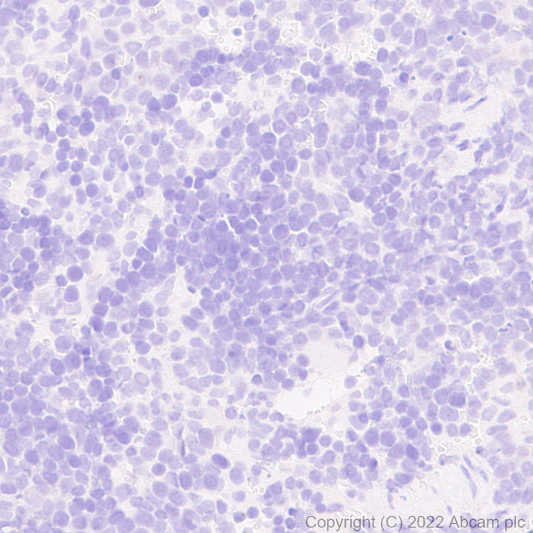 Immunohistochemistry (Formalin/PFA-fixed paraffin-embedded sections) - Anti-GABA A Receptor alpha 5/GABRA5 antibody [N415/24] (AB302962)