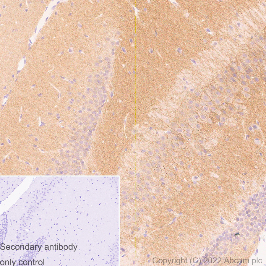 Immunohistochemistry (Formalin/PFA-fixed paraffin-embedded sections) - Anti-GABA A Receptor alpha 5/GABRA5 antibody [N415/24] - BSA and Azide Free (AB302963), expandable thumbnail