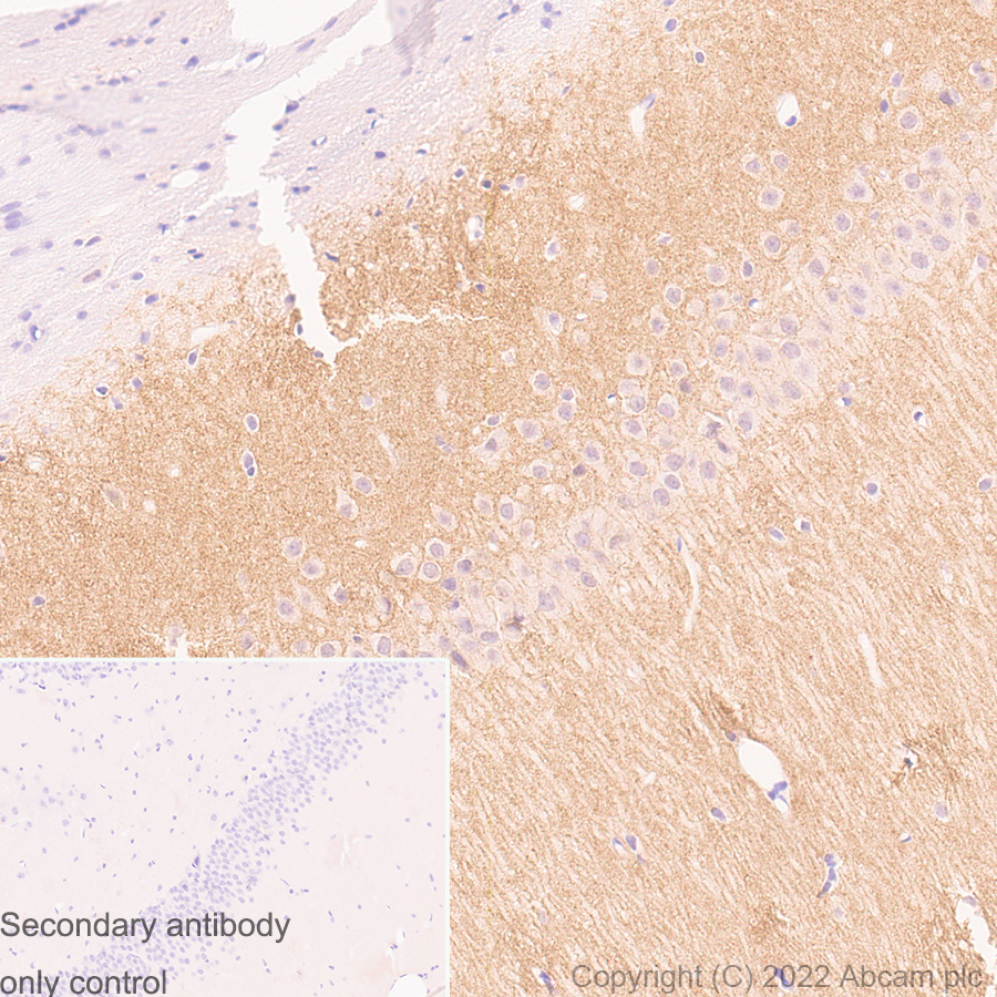 Immunohistochemistry (Formalin/PFA-fixed paraffin-embedded sections) - Anti-GABA A Receptor alpha 5/GABRA5 antibody [N415/24] - BSA and Azide Free (AB302963), expandable thumbnail