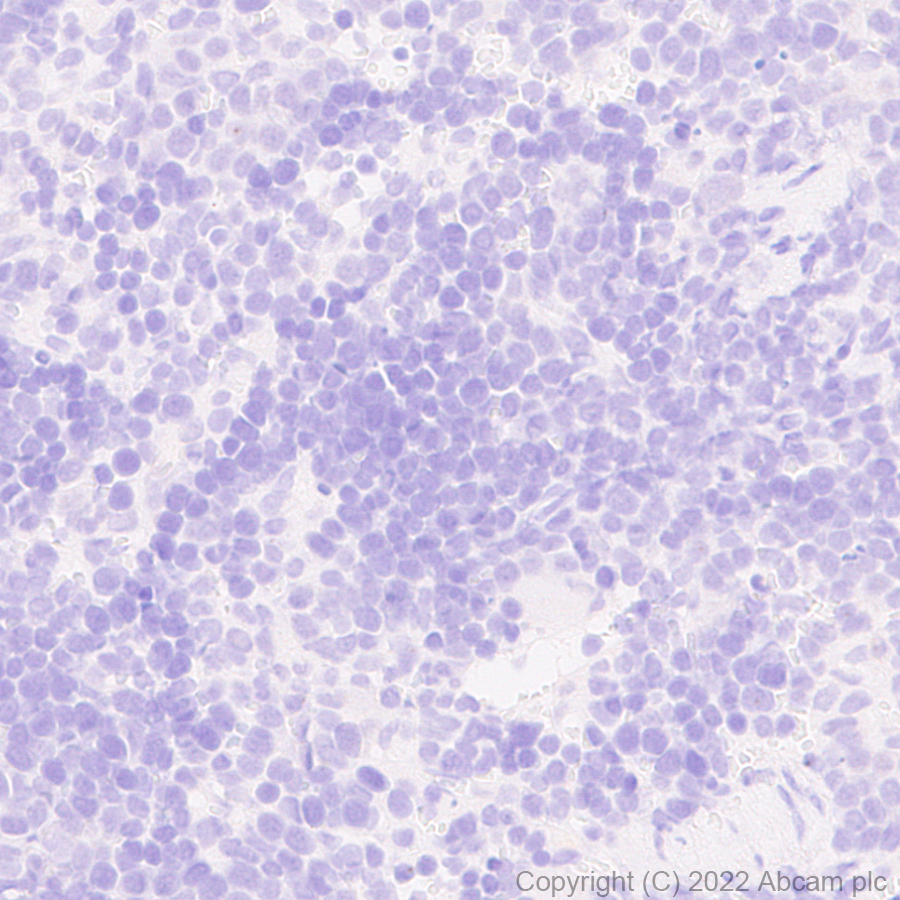 Immunohistochemistry (Formalin/PFA-fixed paraffin-embedded sections) - Anti-GABA A Receptor alpha 5/GABRA5 antibody [N415/24] - BSA and Azide Free (AB302963), expandable thumbnail
