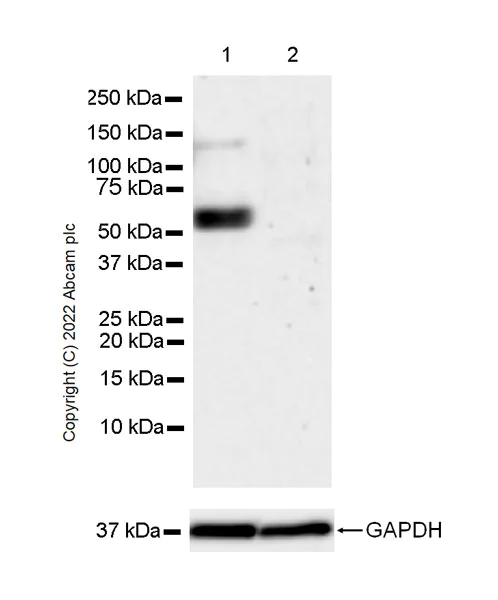 Western blot - Anti-GABA A Receptor alpha 5/GABRA5 antibody [N415/24] - BSA and Azide Free (AB302963)