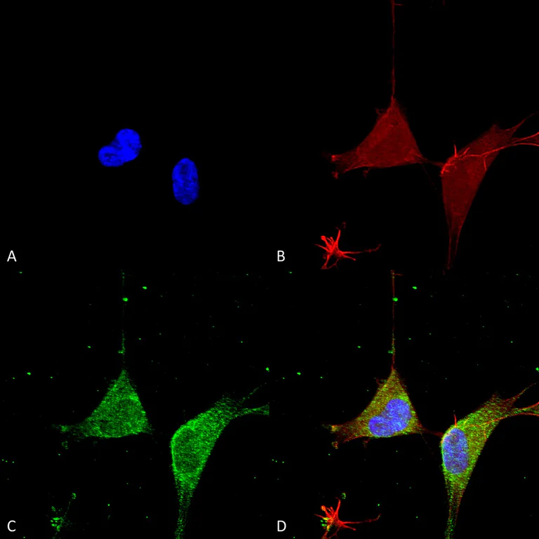 Immunocytochemistry/ Immunofluorescence - Anti-GABA A Receptor alpha 5/GABRA5 antibody [S415-24] (AB242001)
