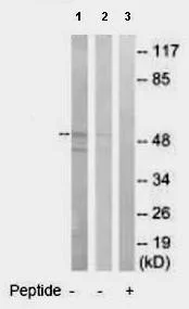 Western blot - Anti-GABA A Receptor alpha 6 antibody (AB92747)