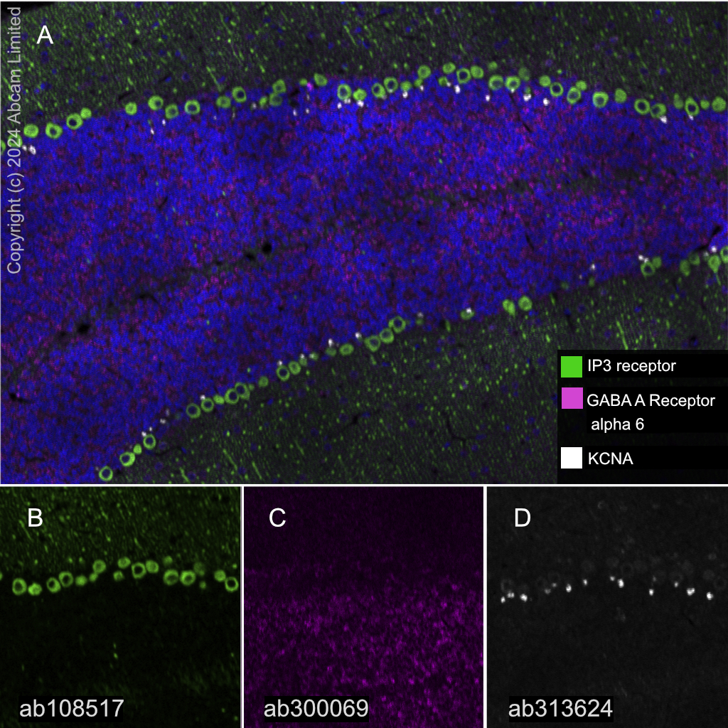 Anti-GABA A Receptor alpha 6 antibody [EPR25322-129] (ab300069