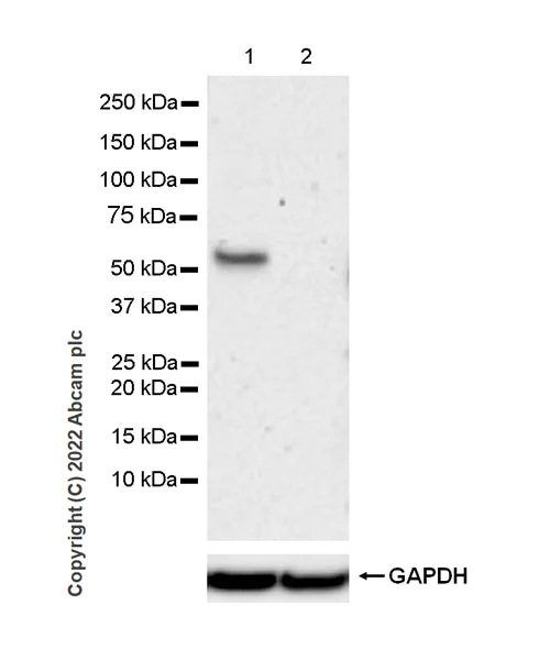 Western blot - Anti-GABA A Receptor alpha 6 antibody [EPR25322-129] (AB300069)