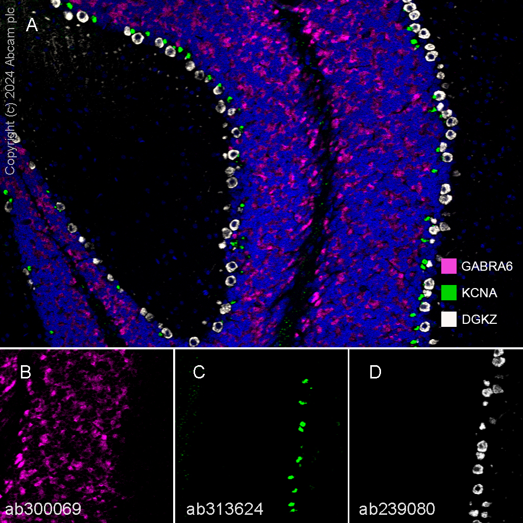 Multiplex immunohistochemistry - Anti-GABA A Receptor alpha 6 antibody [EPR25322-129] - BSA and Azide free (ab300070), expandable thumbnail
