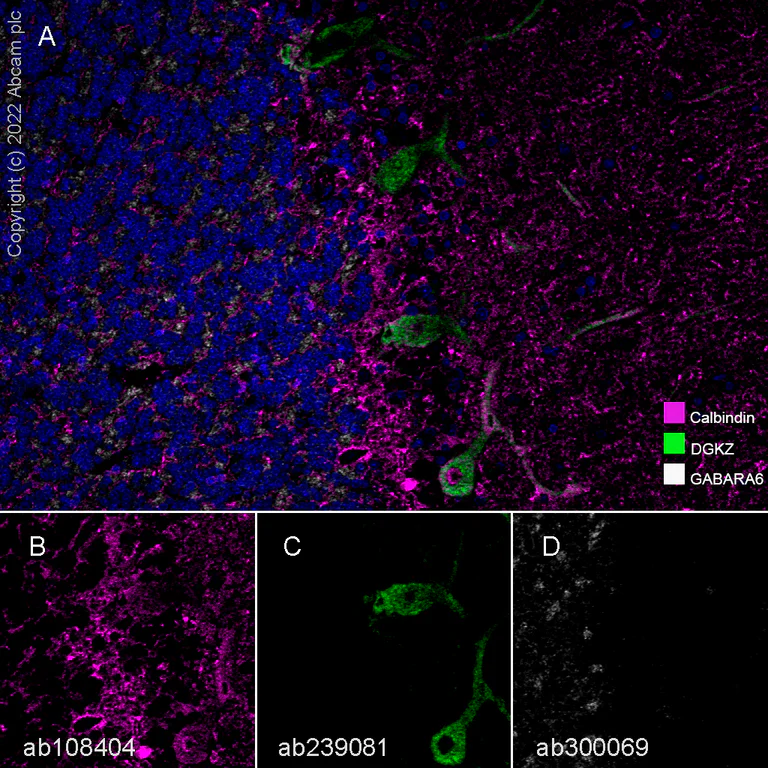 Multiplex immunohistochemistry - Anti-GABA A Receptor alpha 6 antibody [EPR25322-129] - BSA and Azide free (AB300070)