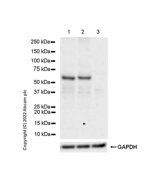 Western blot - Anti-GABA A Receptor alpha 6 antibody [EPR25322-129] - BSA and Azide free (AB300070)