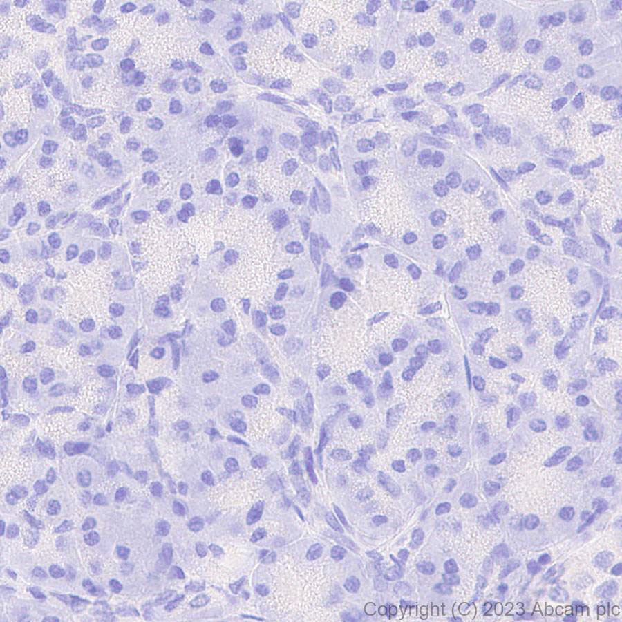 Immunohistochemistry (Formalin/PFA-fixed paraffin-embedded sections) - Anti-GABA A Receptor beta 2 antibody [EPR28366-42] (AB309540)
