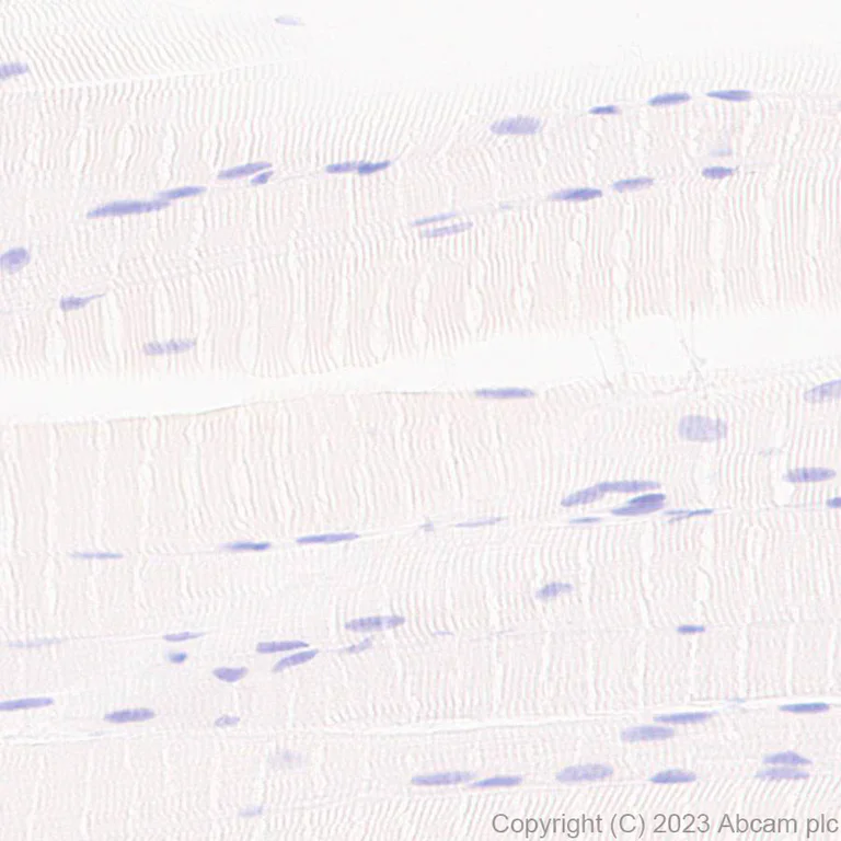 Immunohistochemistry (Formalin/PFA-fixed paraffin-embedded sections) - Anti-GABA A Receptor beta 2 antibody [EPR28366-42] (AB309540)