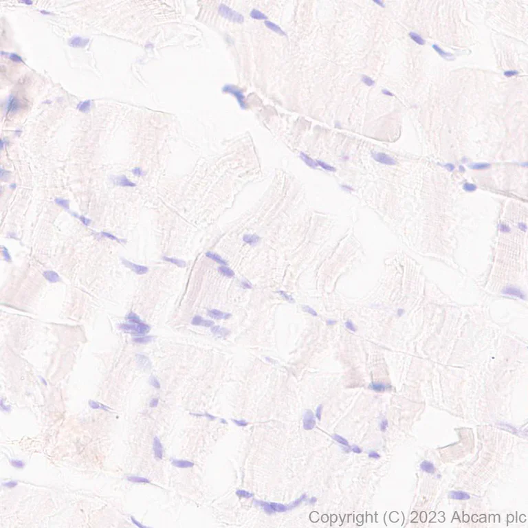 Immunohistochemistry (Formalin/PFA-fixed paraffin-embedded sections) - Anti-GABA A Receptor beta 2 antibody [EPR28366-42] (AB309540)