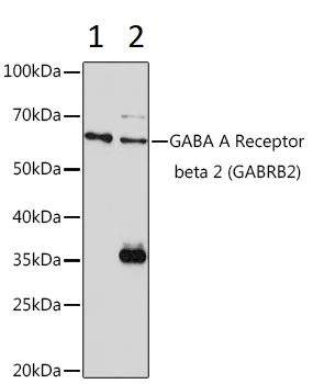 Western blot - Anti-GABA A Receptor beta 2/GABRB2 antibody (AB186875)